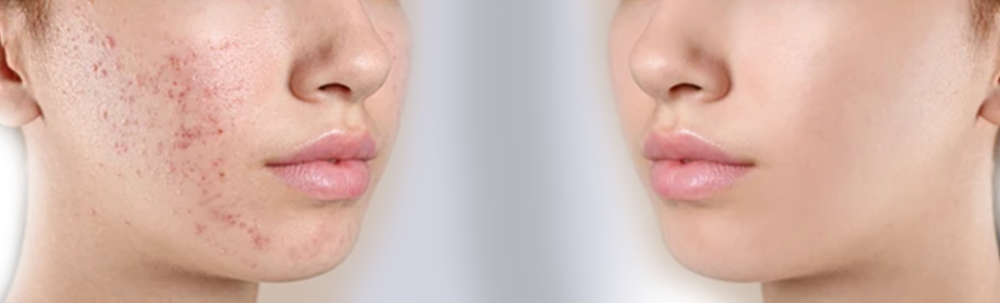 facial-rejuvenation-surgery